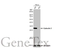 Anti-Galectin 3 antibody [HL2396] used in Western Blot (WB). GTX638613
