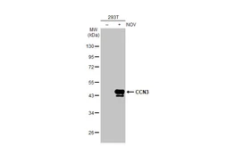 Anti-CCN3 antibody [HL2416] used in Western Blot (WB). GTX638638