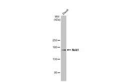 Anti-Nek1 antibody [HL2488] used in Western Blot (WB). GTX638838