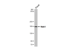 Anti-Nek1 antibody [HL2489] used in Western Blot (WB). GTX638839