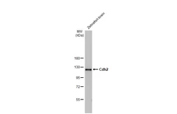 Anti-Cdh2 antibody [HL2496] used in Western Blot (WB). GTX638854