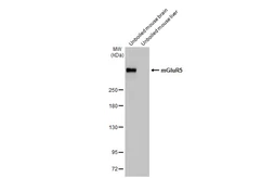Anti-mGluR5 antibody [HL2543] used in Western Blot (WB). GTX638912