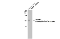 Anti-ProDynorphin antibody [HL2574] used in Western Blot (WB). GTX638952