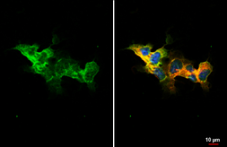 Anti-Smoothened homolog antibody [HL2596] used in Immunocytochemistry/ Immunofluorescence (ICC/IF). GTX639048