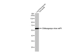 Anti-Chikungunya virus nsP1 antibody [HL2608] used in Western Blot (WB). GTX639060