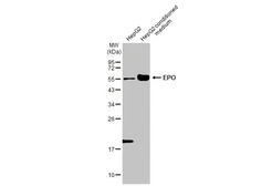 Anti-EPO antibody [HL2752] used in Western Blot (WB). GTX639615