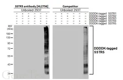 Anti-SSTR5 antibody [HL2756] used in Western Blot (WB). GTX639619