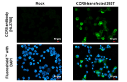 Anti-CCR5 antibody [HL2780] used in Immunocytochemistry/ Immunofluorescence (ICC/IF). GTX639645