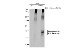 Anti-FSH Receptor antibody [HL2784] used in Western Blot (WB). GTX639652