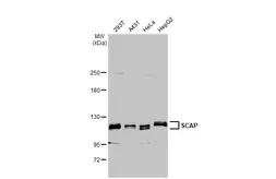 Anti-SCAP antibody [HL2796] used in Western Blot (WB). GTX639684