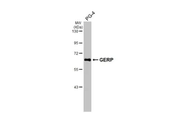 Anti-GERP antibody [HL2797] used in Western Blot (WB). GTX639685