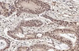 Anti-Mre11 antibody [HL1386-MS] used in IHC (Paraffin sections) (IHC-P). GTX639690