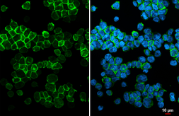 Anti-CCR2 antibody [HL2838] used in Immunocytochemistry/ Immunofluorescence (ICC/IF). GTX640109
