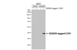 Anti-CCR1 antibody [HL2840] used in Western Blot (WB). GTX640111