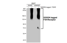 Anti-FSH Receptor antibody [HL2841] used in Western Blot (WB). GTX640112