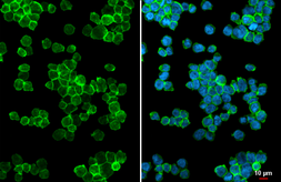 Anti-CXCR3 antibody [HL2843] used in Immunocytochemistry/ Immunofluorescence (ICC/IF). GTX640114