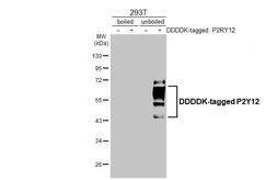 Anti-P2Y12 antibody [HL2847] used in Western Blot (WB). GTX640118