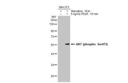 Anti-AKT (phospho Ser473) antibody [HL2871] used in Western Blot (WB). GTX640148