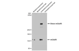 Anti-mGluR5 antibody [HL2876] used in Western Blot (WB). GTX640153