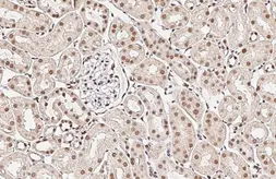 Anti-XPC antibody [HL2894] used in IHC (Paraffin sections) (IHC-P). GTX640231