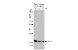 Anti-IL10 antibody [HL2897] used in Western Blot (WB). GTX640234