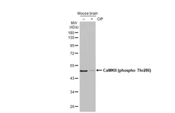 Anti-CaMKII (phospho Thr286) antibody [HL2908] used in Western Blot (WB). GTX640251