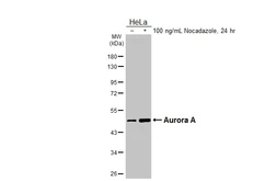 Anti-Aurora A antibody [HL2917] used in Western Blot (WB). GTX640260