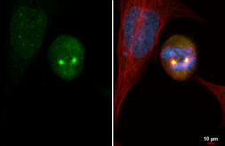 Anti-Aurora A antibody [HL2917] used in Immunocytochemistry/ Immunofluorescence (ICC/IF). GTX640260