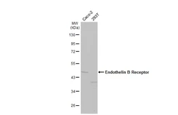 Anti-Endothelin B Receptor antibody [HL2918] used in Western Blot (WB). GTX640261