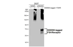 Anti-FSH Receptor antibody [HL2925] used in Western Blot (WB). GTX640268
