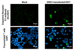 Anti-Dopamine Receptor D1 antibody [HL2927] used in Immunocytochemistry/ Immunofluorescence (ICC/IF). GTX640270