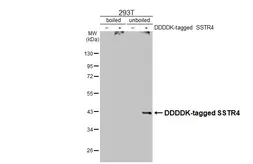 Anti-Somatostatin receptor 4 antibody [HL2933] used in Western Blot (WB). GTX640276