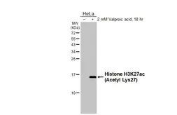 Anti-Histone H3K27ac (Acetyl Lys27) antibody [HL2936] used in Western Blot (WB). GTX640320