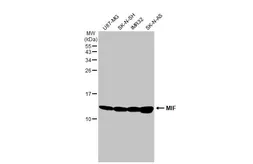 Anti-MIF antibody [HL2963] used in Western Blot (WB). GTX640350