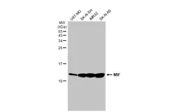 Anti-MIF antibody [HL2964] used in Western Blot (WB). GTX640351