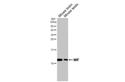 Anti-MIF antibody [HL2964] used in Western Blot (WB). GTX640351