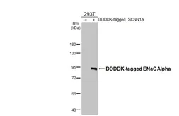 Anti-ENaC Alpha antibody [HL2967] used in Western Blot (WB). GTX640354