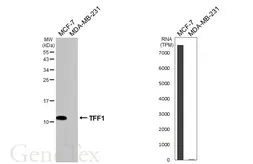 Anti-TFF1 antibody [HL2968] used in Western Blot (WB). GTX640355