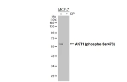 Anti-AKT1 (phospho Ser473) antibody [HL2972] used in Western Blot (WB). GTX640359