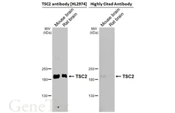 Anti-TSC2 antibody [HL2974] used in Western Blot (WB). GTX640361