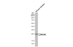 Anti-RGS2 antibody [HL2988] used in Western Blot (WB). GTX640398