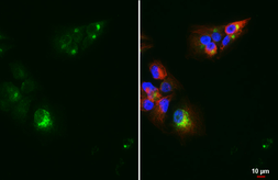 Anti-Chromogranin C antibody [HL2992] used in Immunocytochemistry/ Immunofluorescence (ICC/IF). GTX640402