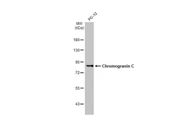 Anti-Chromogranin C antibody [HL2992] used in Western Blot (WB). GTX640402