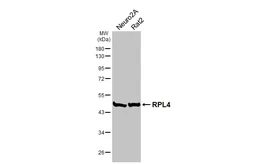 Anti-RPL4 antibody [HL3006] used in Western Blot (WB). GTX640419