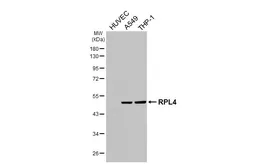 Anti-RPL4 antibody [HL3008] used in Western Blot (WB). GTX640421