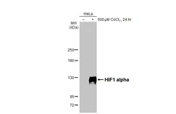Anti-HIF1 alpha antibody [HL3011] used in Western Blot (WB). GTX640424