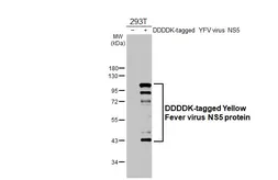 Anti-Yellow Fever virus NS5 protein antibody [HL3014] used in Western Blot (WB). GTX640427
