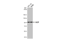 Anti-VCP antibody [HL3018] used in Western Blot (WB). GTX640431