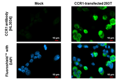 Anti-CCR1 antibody [HL3034] used in Immunocytochemistry/ Immunofluorescence (ICC/IF). GTX640472