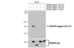 Anti-COL1A1 antibody [HL3040] used in Western Blot (WB). GTX640483